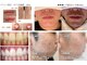 ワイスタイル(Ystyle)の写真