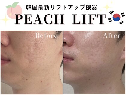 ヘティ バイ ソウル 中目黒(HETIY by Seoul)の写真