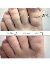 エヌアール(NR)/men's 足の指