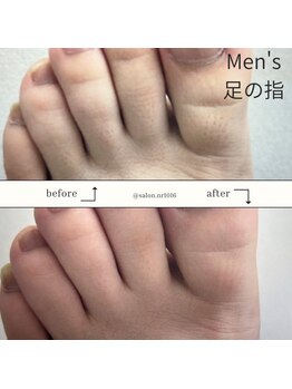 エヌアール(NR)/men's 足の指