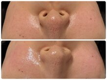 エフェクト 塚口店(effect)/before &nbsp;&nbsp;after