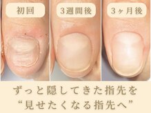 ニコプラス 大橋店(NICO+)の雰囲気（深爪や噛み癖などのお悩みも自爪育成で美しい指先へ♪）
