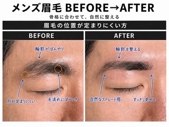 メンズ眉毛サロン LIBRA 心斎橋店【メンズ眉毛/眉毛サロン/アイブロウ/眉ワックス】の写真/【清潔感UP】眉周りの産毛をワックス脱毛で徹底オフ!青ヒゲ感のないツルツルで爽やかな美肌へ導きます★