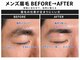 メンズ眉毛サロン LIBRA 心斎橋店【メンズ眉毛/眉毛サロン/アイブロウ/眉ワックス】の写真/【清潔感UP】眉周りの産毛をワックス脱毛で徹底オフ!青ヒゲ感のないツルツルで爽やかな美肌へ導きます★