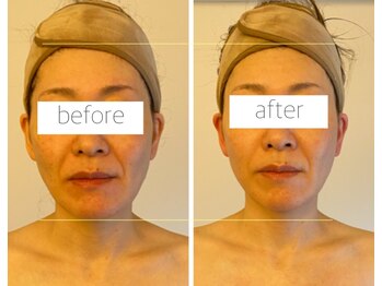 パル コルギサロン(Pal. Korugi salon)/コルギビフォーアフター