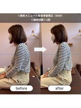 オリガミ鍼灸接骨院 旭丘院/【Before/After】産後骨盤矯正
