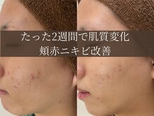 アエオボンヌール(A.E.O BONHEUR)