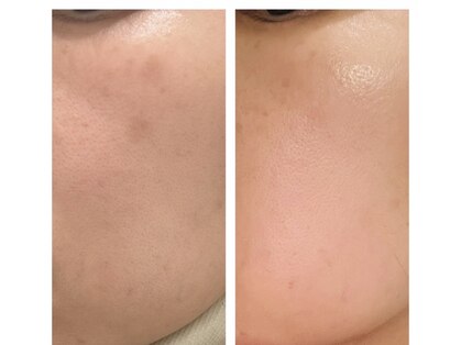 シーラ(CEILA)の写真