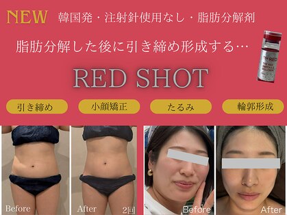 なごみ 菊池店の写真