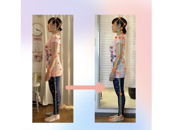 整体院 ツイてる(椎照)の写真/首肩の辛さは”姿勢崩れ”が原因です