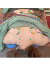 鍼呼灸 森の音/鍼灸施術のイメージです