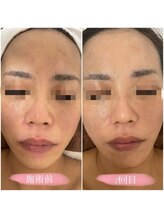 ∞ 心斎橋(エイト)/クリスティーナ　アンストレス