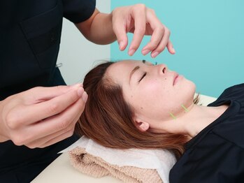 ハル鍼灸整骨院 尼崎院(HALU鍼灸整骨院)の写真/しわ・たるみ改善/小顔/眼精疲労/冷えにも◇美容鍼で血行を改善し免疫力UP＆自律神経を整えるW効果◎