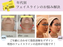 ジ エステティック イーズ サクラマチ熊本店/イーズのレモンボトルが凄い　2