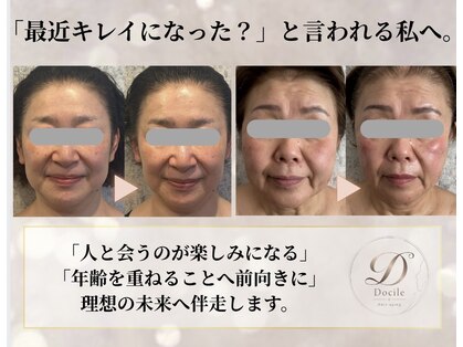 ネイルアンドアンチエイジングドゥシール(Docile)の写真