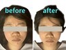 【小顔矯正：120分】 顎のズレ・顔の左右差の改善はこちら 14000円→