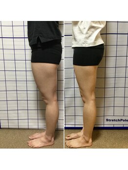 アリス フィットネスサロン/*施術効果*