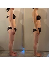 ラナ 京都西院店(Lana)/よもぎ蒸し＆リンパマッサージ