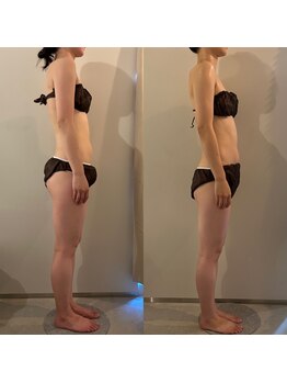 ラナ 京都西院店(Lana)/よもぎ蒸し＆リンパマッサージ