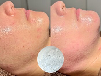 ルーナジェーナ(Luna llena)/