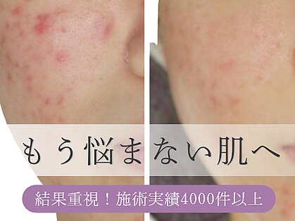 ニコリ(NICOLI)の写真