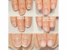 ニコプラス 大橋店(NICO+)/自爪育成中（クリア仕上げ）