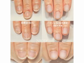 自爪育成中（クリア仕上げ）