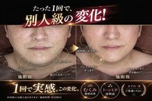 ティースキンサロンオキナワ(T-skin salon Okinawa)