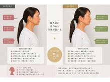 ライフ ピラティス スタジオ(LIFE Pilates Studio)/無理なく自然に戻す