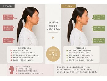 ライフ ピラティス スタジオ(LIFE Pilates Studio)/無理なく自然に戻す