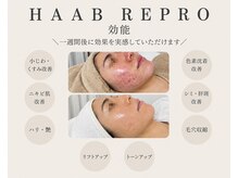 クレア(CLEA)/