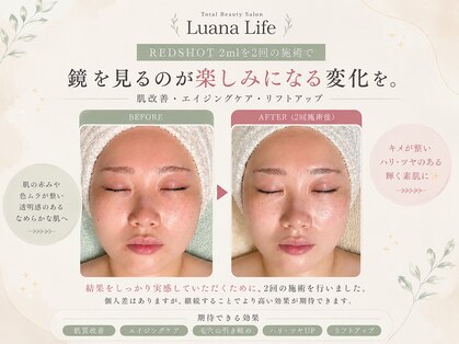 ルアナライフ(Luana Life)の写真