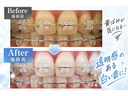 ホワイトニングショップ 大阪玉造店の写真