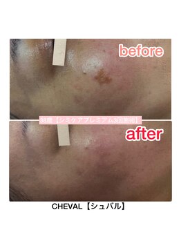 シュバル(CHEVAL)/シミ改善は当店にお任せ下さい♪