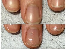 グレースレディ/噛み、むしり癖の方に