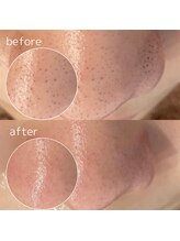 ペイジ(peige)/【peige】症例写真