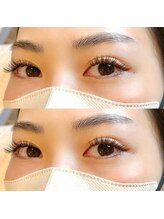 シャルム(Charme)/バインドロック