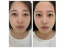 眉の左右差悩みも◎まつげパーマ/パリジェンヌ/眉毛/アイブロウ