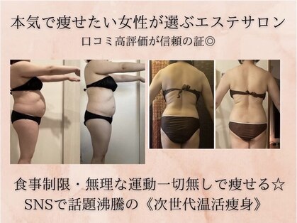 ヨサパーク ソルナ(YOSA PARK Soluna)の写真