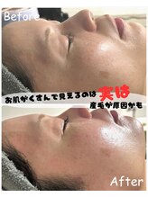 ジョエルワックス 沖縄糸満店(JOELLE WAX)/くすみがちなお肌も透明感へ