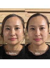 ピンクッション 平尾(PINKSHION)&nbsp;Before After