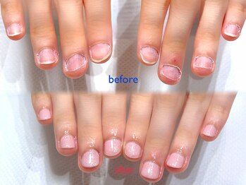 ヘアーデザイン ジュモク(Jumoku)の写真/深爪・爪の悩み、もう悩まない!美爪育成と深爪矯正でコンプレックス改善◎ (40文字)