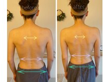 パル コルギサロン(Pal. Korugi salon)/コルギビフォーアフター