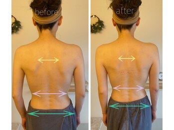 パル コルギサロン(Pal. Korugi salon)/コルギビフォーアフター