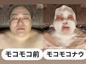 ソーレエルーナ(SOLE e LUNA)/白玉ホイップ 肌 くすみ 汚れ