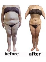 ウィズルーチェ つくばみどりの店(with luce)/衝撃のbefore/after 50代