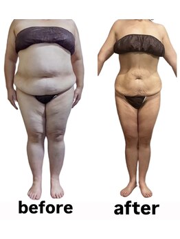 ウィズルーチェ つくばみどりの店(with luce)/衝撃のbefore/after 50代