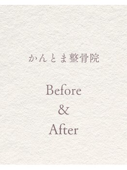 かんとま整骨院 中区鶴舞院/Before→Afterで変化実感