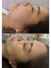 マホロバ セカンド(mahoroba 2nd)/ララピール＋よもぎ蒸し