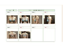 エステティック レイビス 池袋店(RAYVIS)/【コンテスト写真】